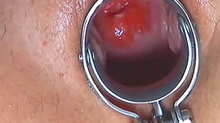 Vaginal Training In A Hot Fisting Session For Tiffany
